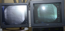 two screens with radiology images